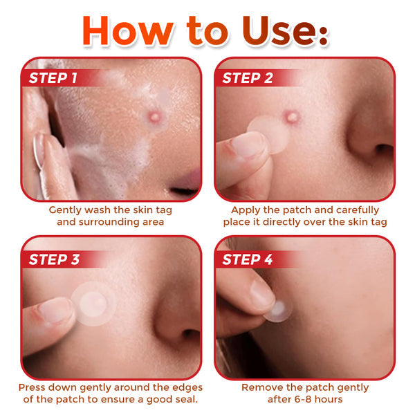 🎁 2-in-1 Bye-Bye Pimples Patch|Raised Moles,Acne Flat Warts & Skin Tags Remover