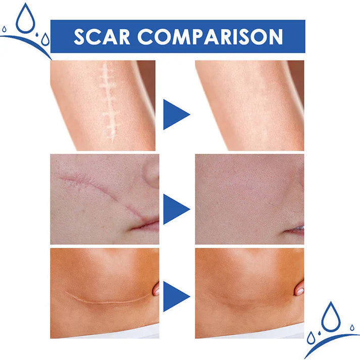 🔥Limited-time 50% sale--LUMIVO Scar Repair Cream — Smooth, Clear, Confident Skin