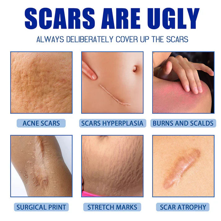 🔥Limited-time 50% sale--LUMIVO Scar Repair Cream — Smooth, Clear, Confident Skin